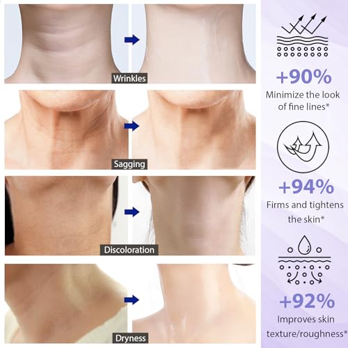 New Neck Firming Tightening Cream: Anti Aging Wrinkle Cream on Neck & Décolleté, Tighten and Lift Neck Cream for Fine Lines, Sagging Crepe Skin, Skin Care Moisturizer Face Cream, Day & Night - 1.7 oz