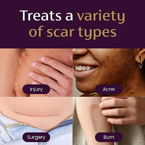 Mederma Advanced Scar Gel, Treats Old and New Scars, Reduces the Appearance of Scars from Acne, Stitches, Burns and More, 0.70oz (20g)
