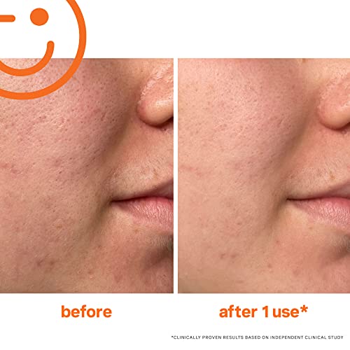 Kate Somerville ExfoliKate Intensive Scrub for Pores