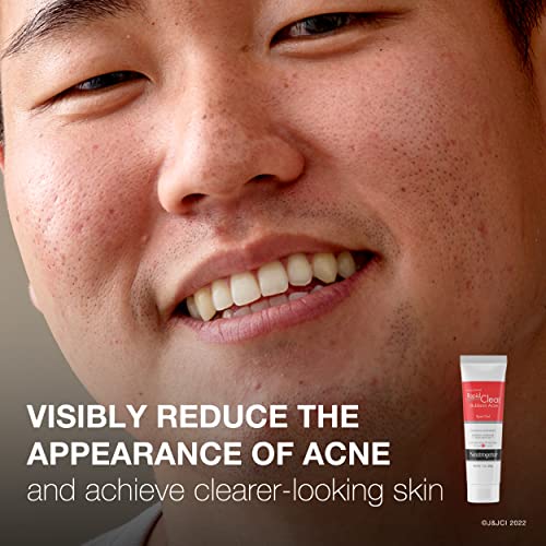 Neutrogena Rapid Clear Stubborn Acne Spot Treatment Gel with Maximum Strength 10% Benzoyl Peroxide Acne Treatment Medication, Pimple Cream for Acne Prone Skin Care, 1 oz