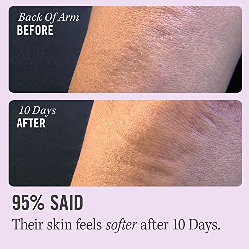 KP Bump Eraser Exfoliating Body Scrub 8 oz