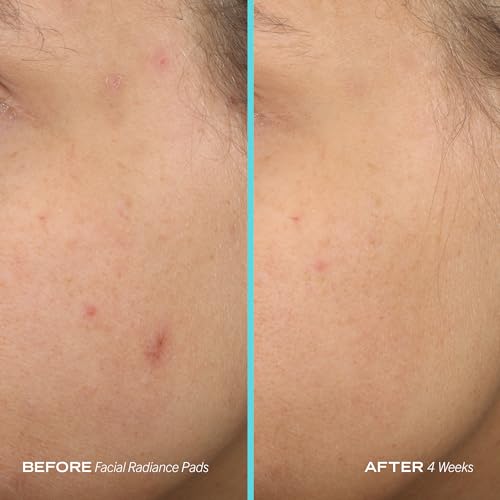 Facial Radiance Exfoliating Pads - 28 Daily Use