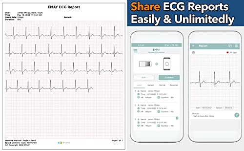 EMAY Portable ECG Monitor with LCD Screen