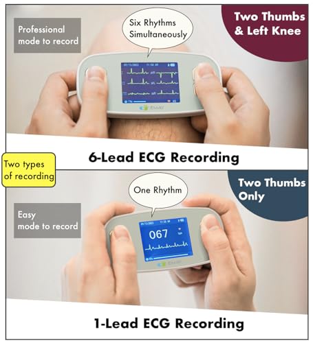 EMAY 6L Portable ECG Monitor for Heart Health