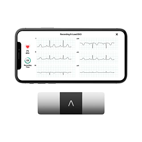 KardiaMobile 6-Lead EKG Monitor - AFib Detection