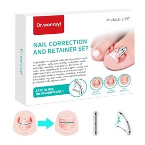 Titanium Ingrown Nail Correction Tool Set