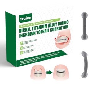 Titanium Ingrown Toenail Repair Kit (10 pcs)