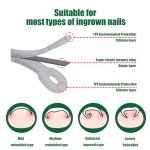 Titanium Ingrown Toenail Repair Kit (10 pcs)