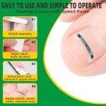 Titanium Ingrown Toenail Treatment and Removal Kit