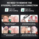 Titanium Ingrown Toenail Treatment and Removal Kit