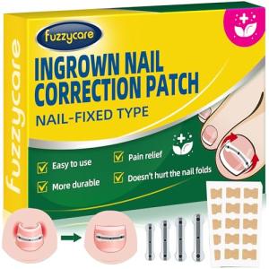 Titanium Ingrown Toenail Treatment and Removal Kit