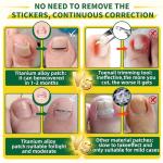 Titanium Ingrown Toenail Treatment and Removal Kit