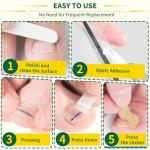 Titanium Ingrown Toenail Treatment and Removal Kit