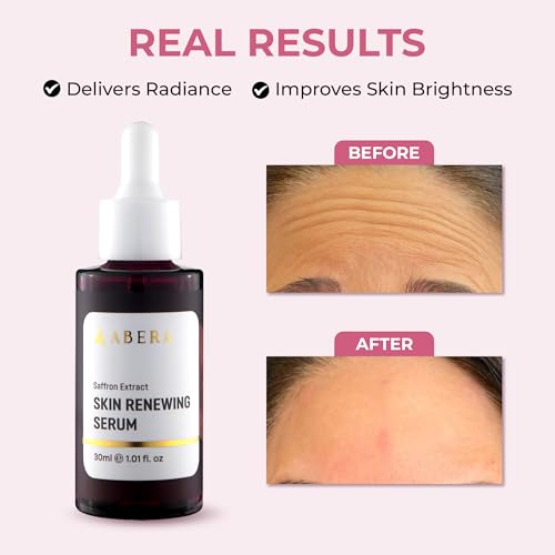 Saffron Serum for Melasma and Anti-Aging 1.01 Fl Oz