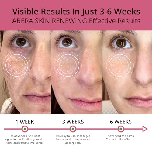 Saffron Serum for Melasma and Anti-Aging 1.01 Fl Oz