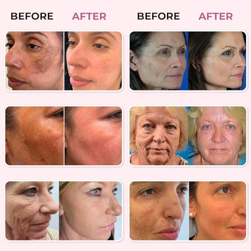 Saffron Serum for Melasma and Anti-Aging 1.01 Fl Oz