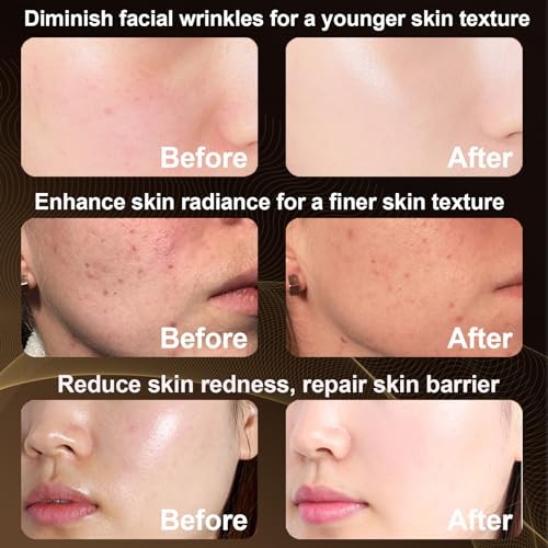 Portable Rechargeable Red Light Therapy Face Mask