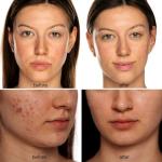 Avorla LED Facial Mask: Red, Infrared & Blue الضوء