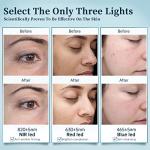 Wireless LED Face Mask for Anti-Aging