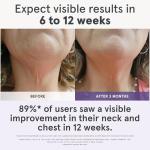 iRestore LED Neck & Chest Anti-Aging Mask