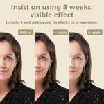 Pretticip Red Light Therapy Skin Tightening Wand