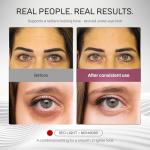 Numiere Time Keeper LED Face Mask – Multi-Wavelength Skincare Device