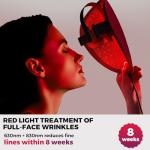 QuasarMD 3D LED Face Mask for Radiant Skin