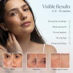 LED Light Therapy Mask for Acne and Wrinkles