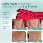 AURELUX Portable Red Light Therapy for Neck