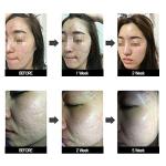 CF Magic LED Mask. 480 LED Near Infrared - Helps Skin Rejuvenation, Facial Skin Care, Anti Aging, Skin Wrinkle/Aging Care, Whitening, Lifting and Scalp/Hair Growth Care.