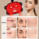 7-Color LED Red Light Therapy Face Mask