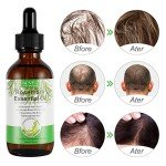 Rosemary Oil for Hair and Skin Care