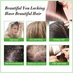 Rosemary Oil for Hair and Skin Care