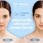 13-in-1 Vitamin B Complex Plus with Vitamin B1, B2, B3 (Niacinamide), B4, B5, B6, B7 (Biotin), B8 (Inositol), B9 (Folate), B12, C, D3, K2 - Energy, Nerve, Immune, Skin Support - 120 Vegan Capsules