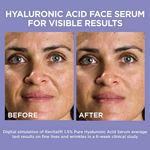L'Oreal Paris Revitalift 1.5% Pure Hyaluronic Acid Face Serum + Hyaluronic Acid Eye Serum to Hydrate and Visibly Plump Skin + Moisturizer Sample​