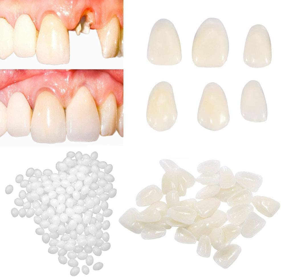 Tooth Repair Kit-Thermal Fitting Beads Granules and Fake Teeth for Temporary Fixing Missing and Broken Tooth | Replace a Missing Tooth in Minutes for Women and Man