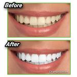 Miracle Teeth Whitener - Coconut Charcoal Powder
