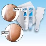 Clear Callus Remover Kit for Smooth, Healthy Feet