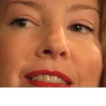 EasyLift 60-Second Eye Lift – As Seen on TV