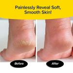 Cordless Motorized Callus Remover w/ LED Light