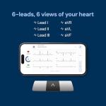 KardiaMobile 6-Lead EKG Monitor for Home Use