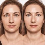 Catrice | True Skin High Cover Concealer (002 | Neutral Ivory) | Waterproof & Lightweight for Soft Matte Look | With Hyaluronic Acid & Lasts Up to 18 Hours | Vegan, Cruelty Free