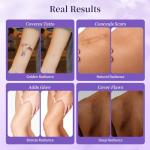 Tattoo Cover Up Makeup, Body Coverage Perfector Waterproof for Leg & Body Makeup, Bruise Scar Make up Tattoo Concealer Skin Full Coverage with Long Lasting 3.5oz, Bronze Radiance