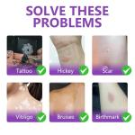 Tattoo Cover Up Makeup Waterproof, 2 Colors Tattoo Concealer, Invisible Tattoo Cover Up, Suitable for Tattoos Scars and Spots, for All Skin Types