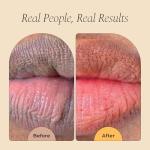 Glo Melanin All Natural Lemon and Turmeric Lip Balm - Natural Lip Balm Illuminate Your Smile, Brighten & Nourish Dark Lips Effortlessly - For Smokers Lips