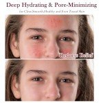 Pore Minimizing Organic Skin Care Gift Set