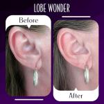 Lobe Wonder - The ORIGINAL Ear Lobe Support Patch for Pierced Ears - Eliminates the Look of Torn or Stretched Piercings - Protects Healthy Ear Lobes from Tearing - 60 Patches - Clear & Latex-Free