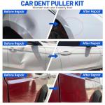 Car Dent Puller Kit, 53Pcs Paintless Dent Removal Kit with Adjustable Bridge Puller & Golden Lifter, Dent Repair Kit for Car Hail Damage Large & Small Dent, Refrigerator Door Dent DIY Removal