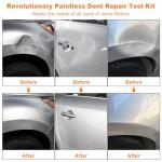 97-Piece Paintless Dent Removal Kit for Cars