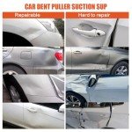 2 Pack Car Dent Puller Kit - Strong Suction Cups